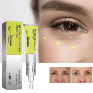 קרם עיניים הזרקות מיצוק רטינול- הפחתת קמטים